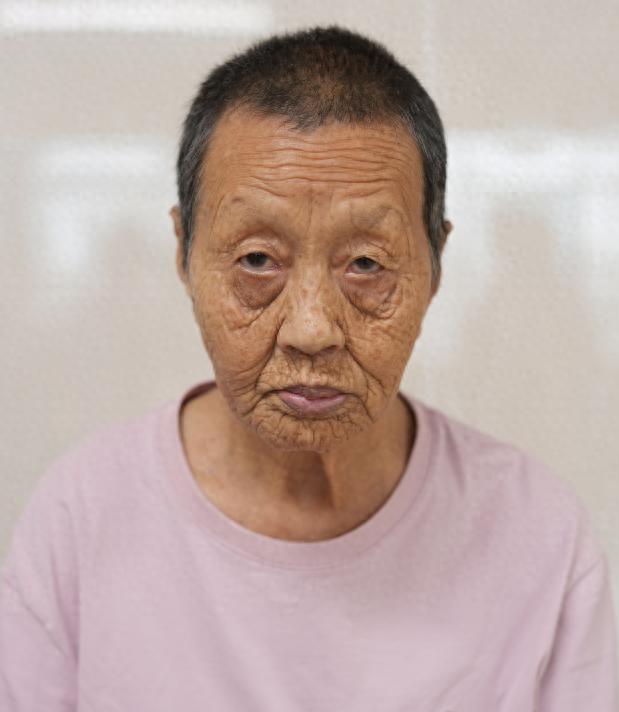走失者照片 厦门市寻亲：八旬老太被救助多年，自...