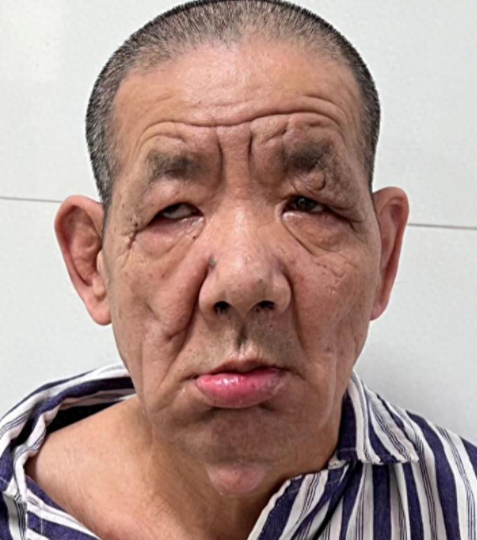 走失者照片 汕头寻亲：七旬老人被救助，自写名为...