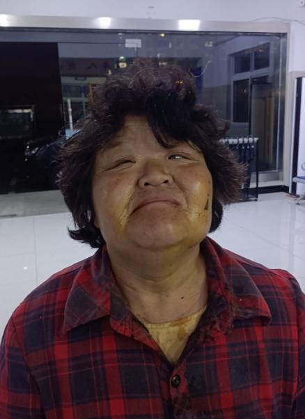走失者照片 襄阳市寻亲：五旬女子被救助，穿红黑...