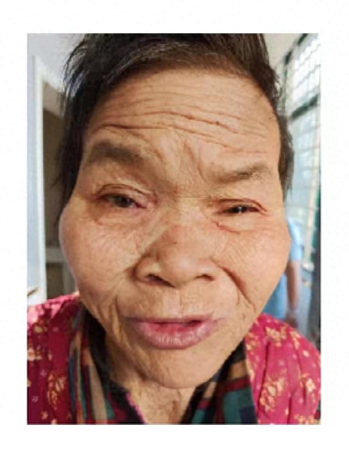 走失者照片 商丘市寻亲：七旬老太被救助，高1米...