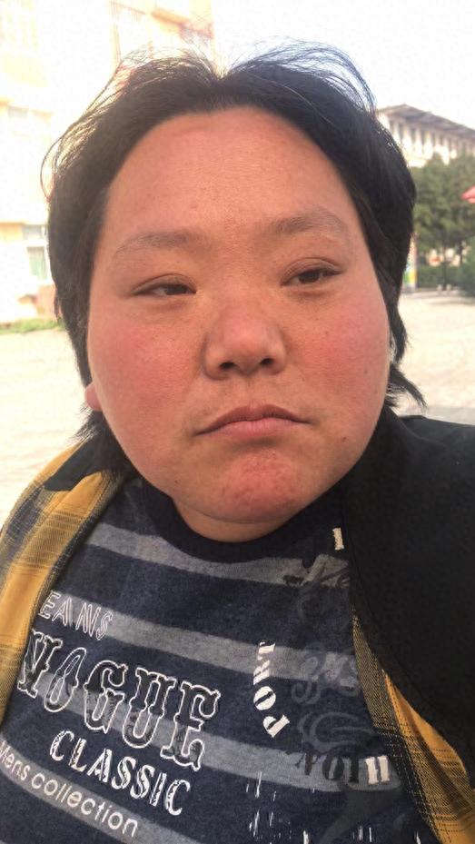 走失者照片 洛阳市寻亲：青年女子被救助，穿黄黑...