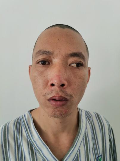 走失者照片 珠海市寻亲：青年男子被救助多年，自...