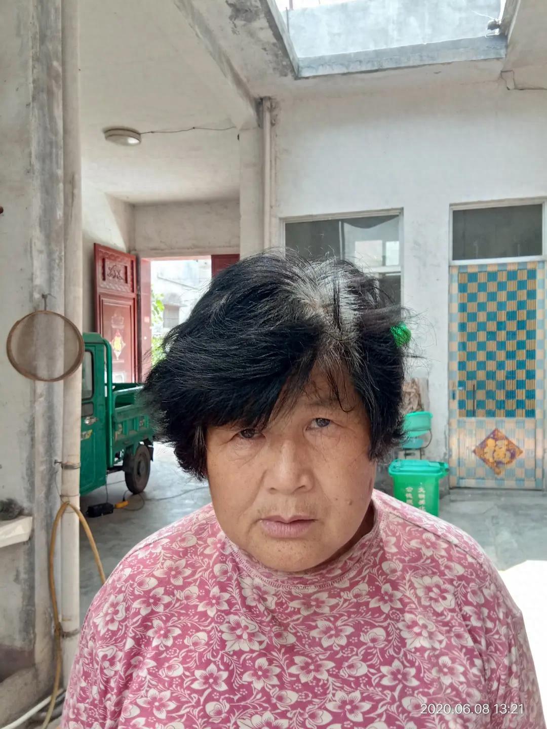 走失者照片 枣庄市滕州市急寻：六旬老太走失，患...