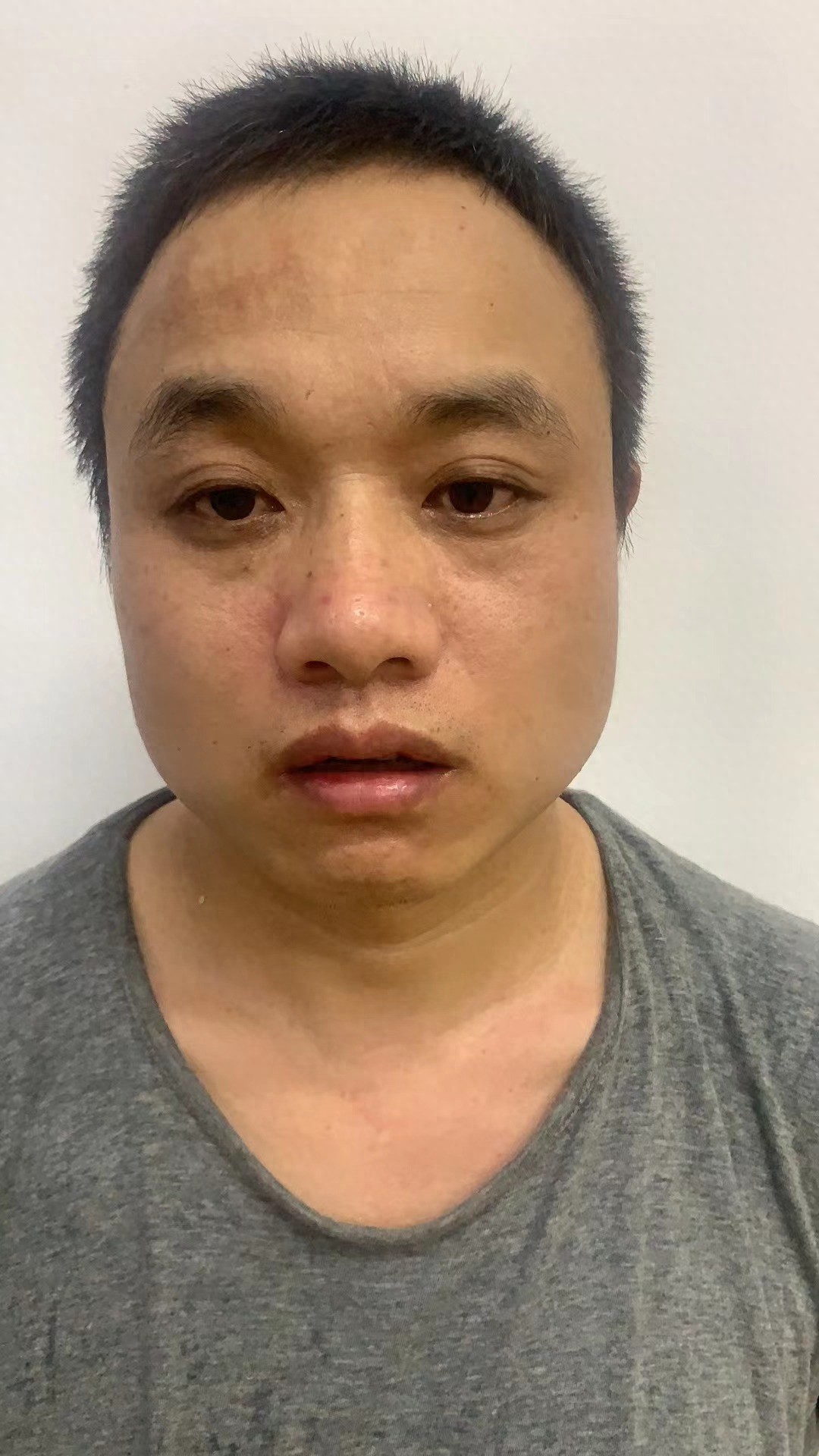 走失者照片 梅州市寻亲：中年男子被救助，穿灰色...