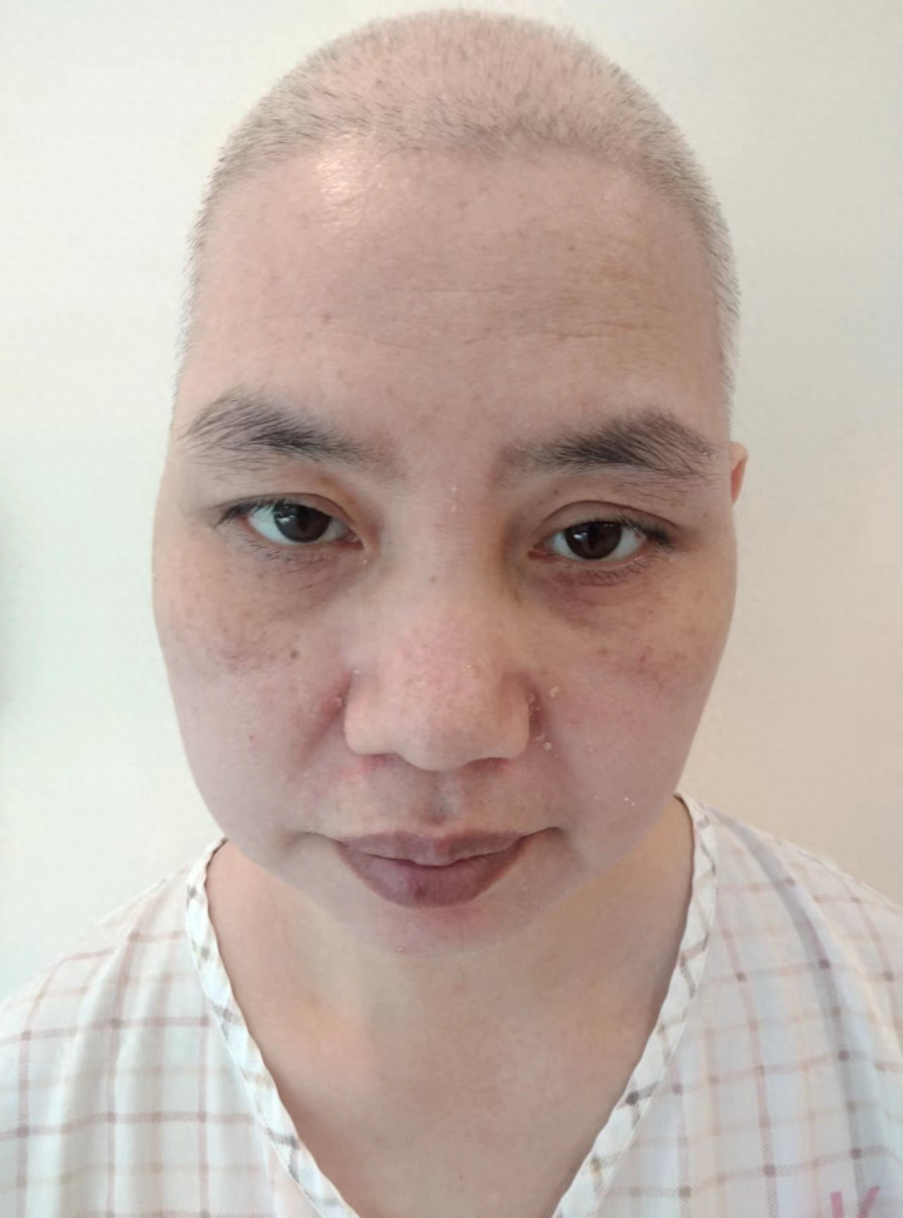 走失者照片 深圳市寻亲：五旬女子被救助，高1米...