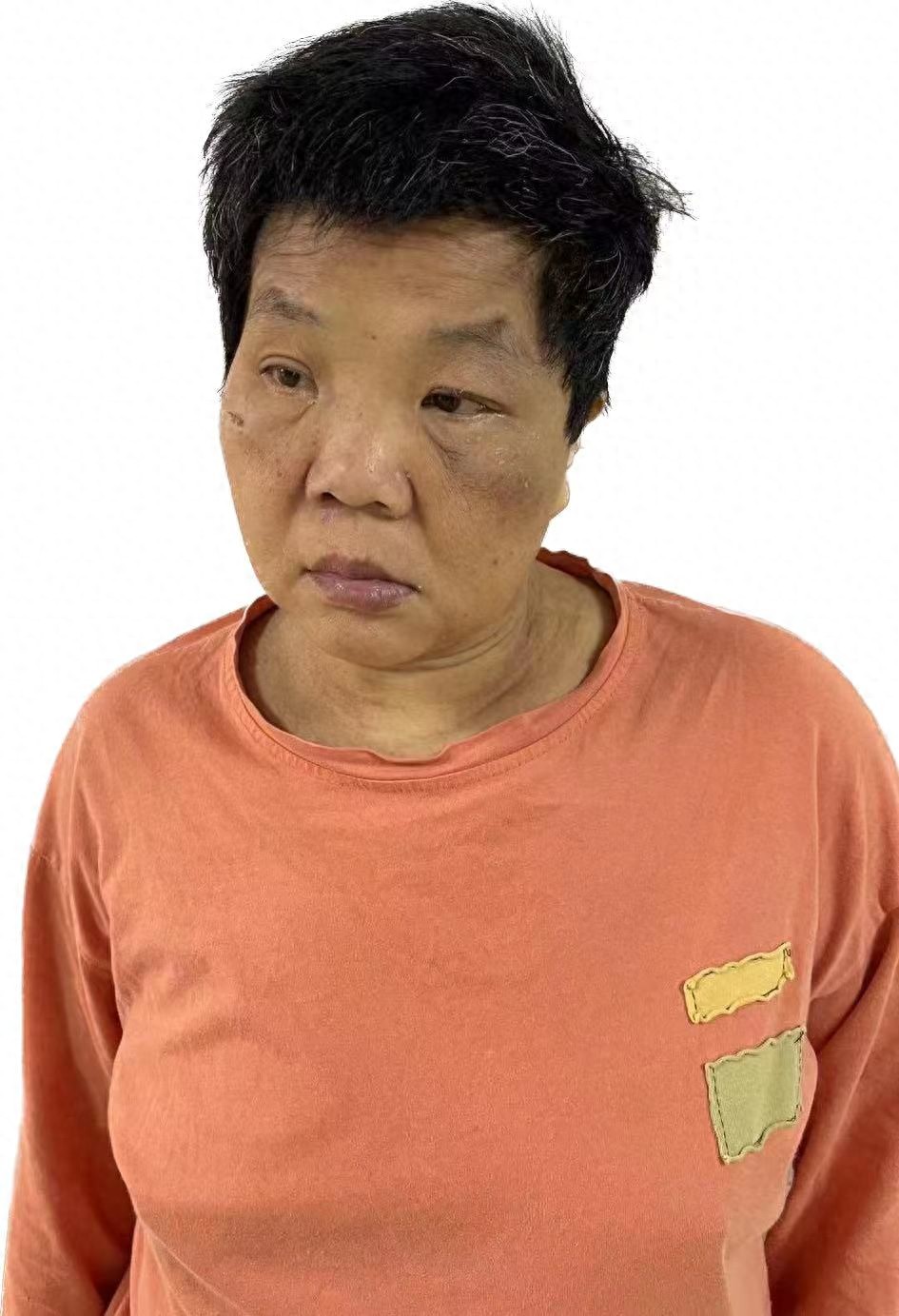 走失者照片 汕头市寻亲：五旬女子被救助，自述叫...
