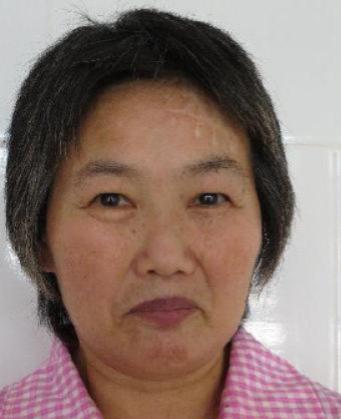 走失者照片 广州市寻亲：六旬老太被救助，额头左...