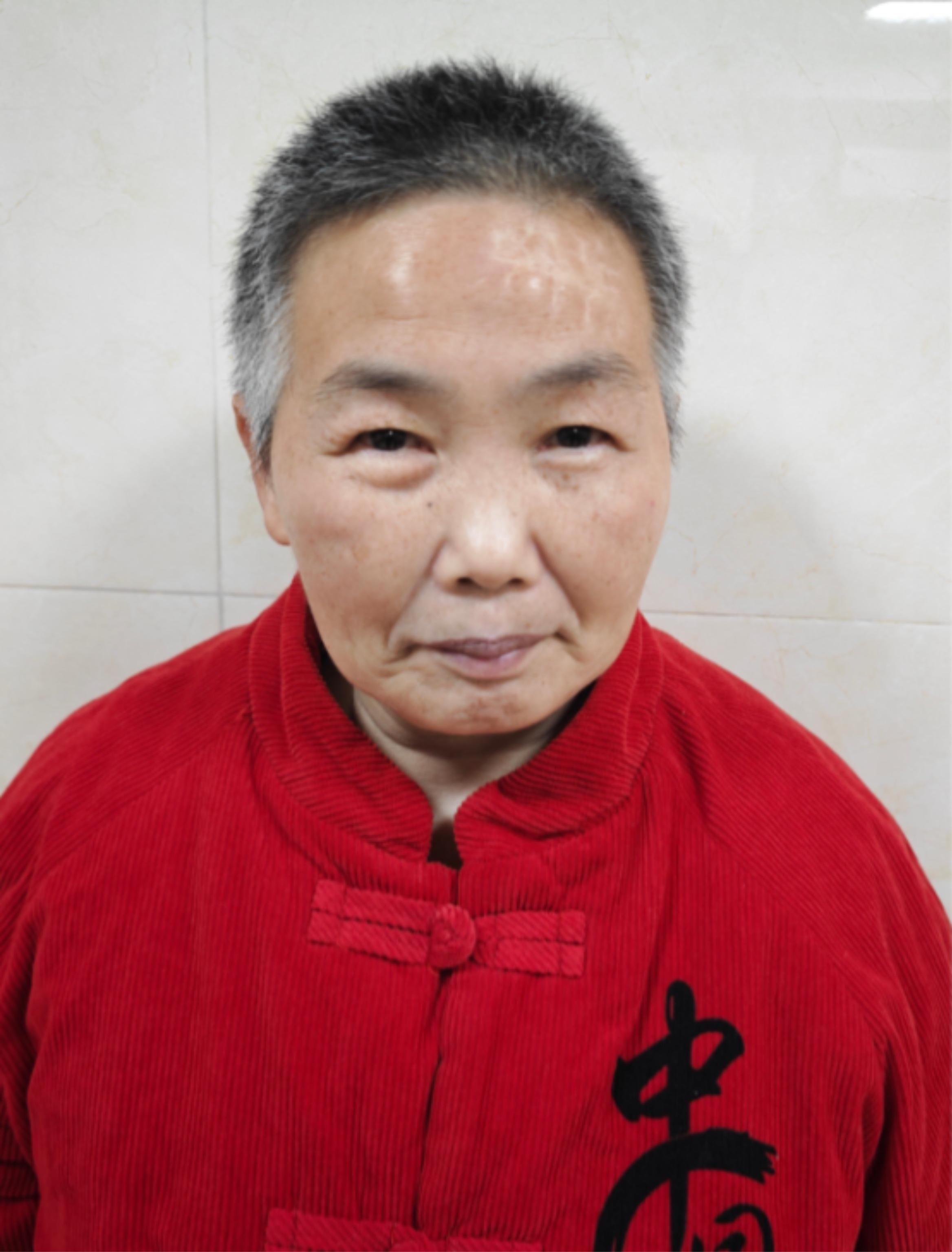 走失者照片 广州市寻亲：六旬老太被救助，额头左...