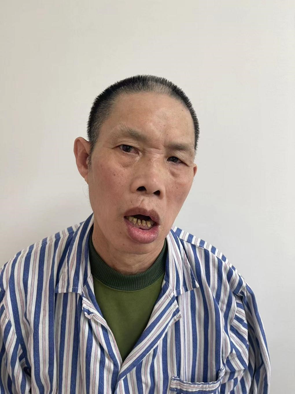 走失者照片 宁波市寻亲：五旬男子被救助数年，自...