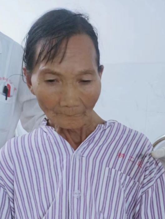 走失者照片 北海市寻亲：六旬老太被救助，头部包...