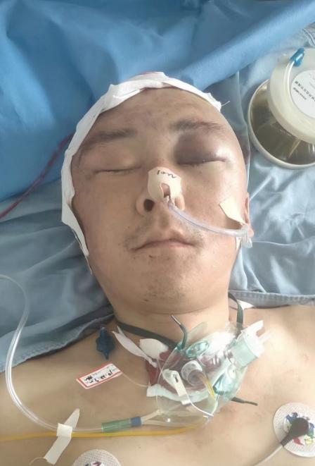 走失者照片 患者寻亲：沧州市青年男子因脑外伤被...