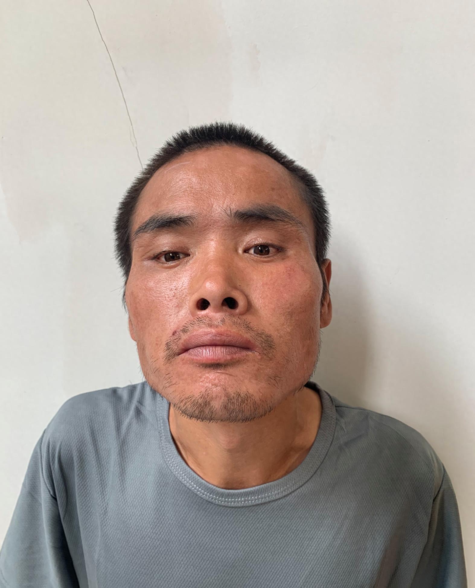 走失者照片 济南市寻亲：青年男子被救助多年，高...