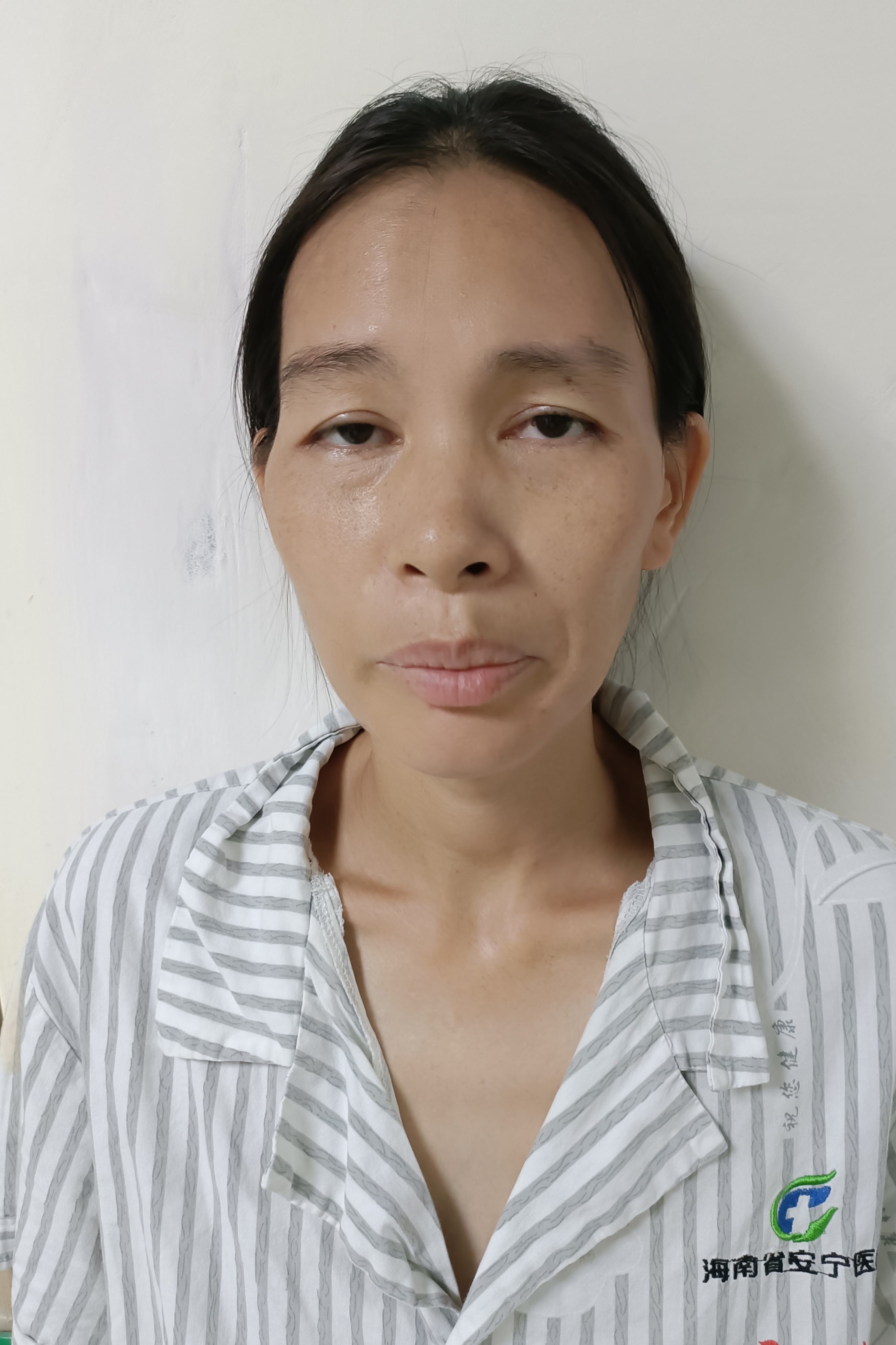 走失者照片 海口市寻亲：青年女子被救助，自述叫...