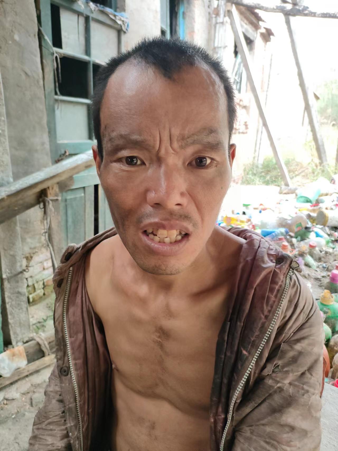 走失者照片 东营市寻亲：中年男子被救助，高1米...