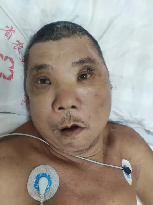 走失者照片 海南省临高县寻亲：五旬男子被救助，...
