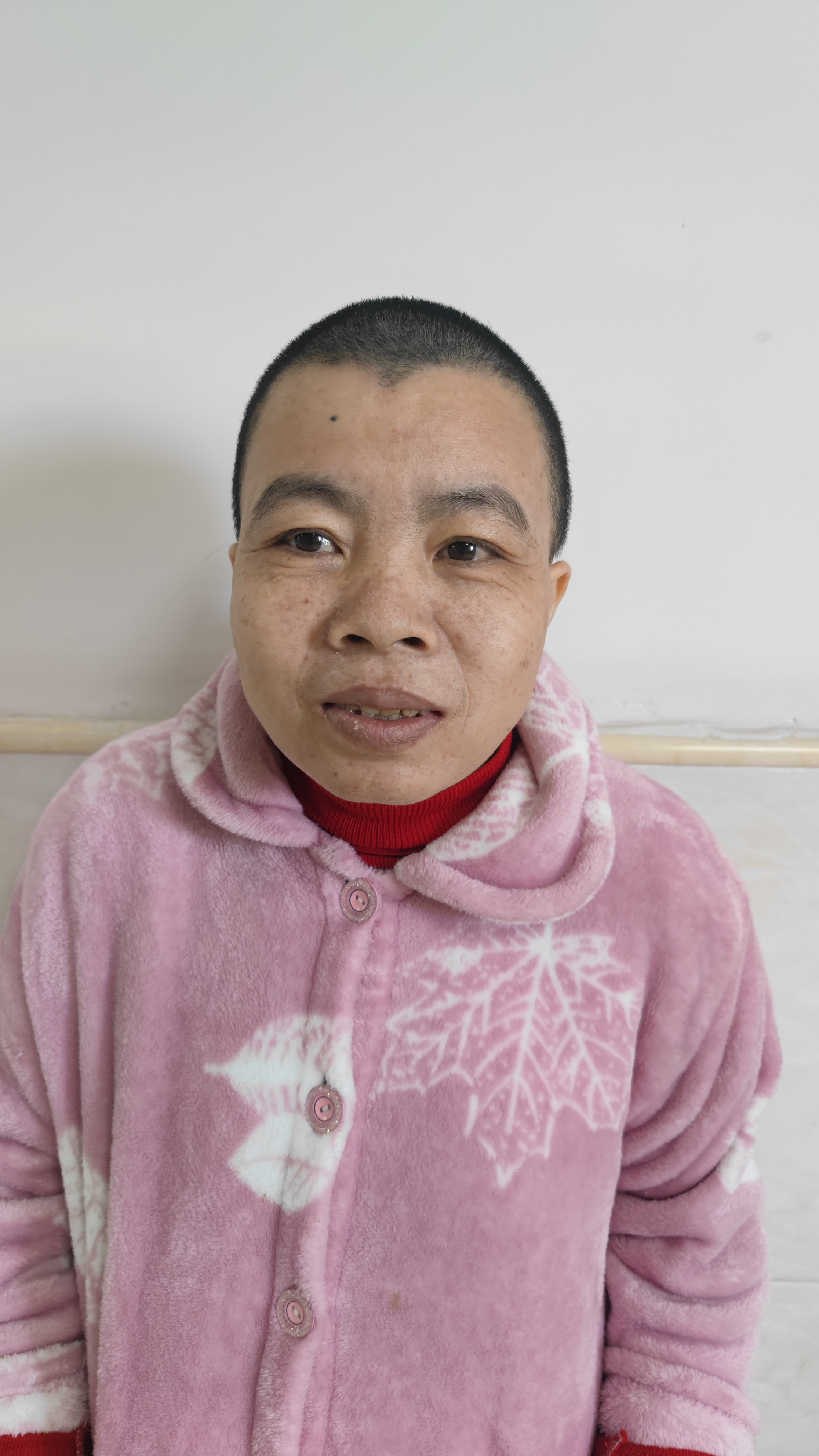 走失者照片 梅州市寻亲：中年女子被救助，疑似兴...
