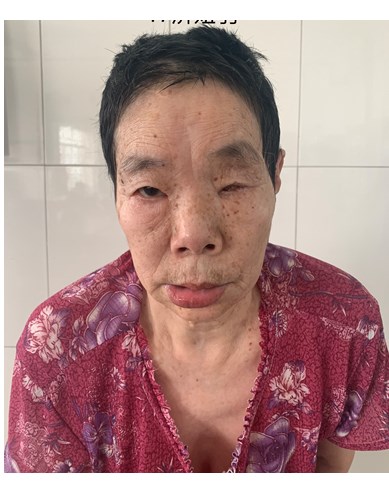 走失者照片 济南市寻亲：六旬老太被救助，自述叫...