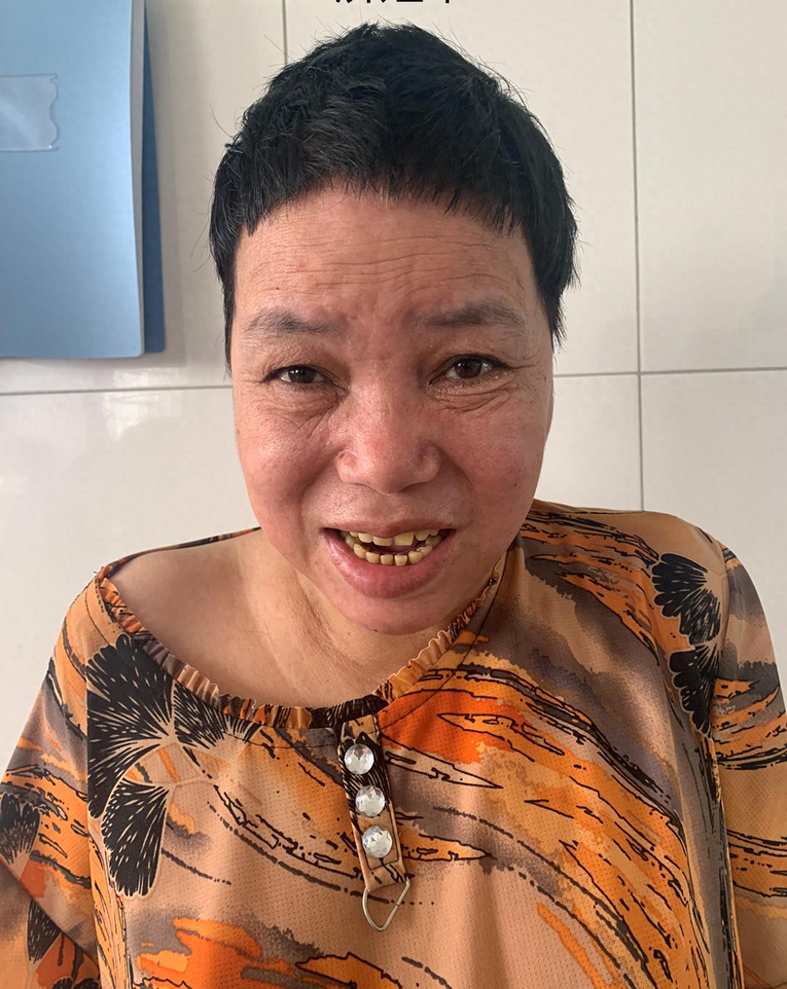 走失者照片 济南市寻亲：中年女子被救助，高1米...
