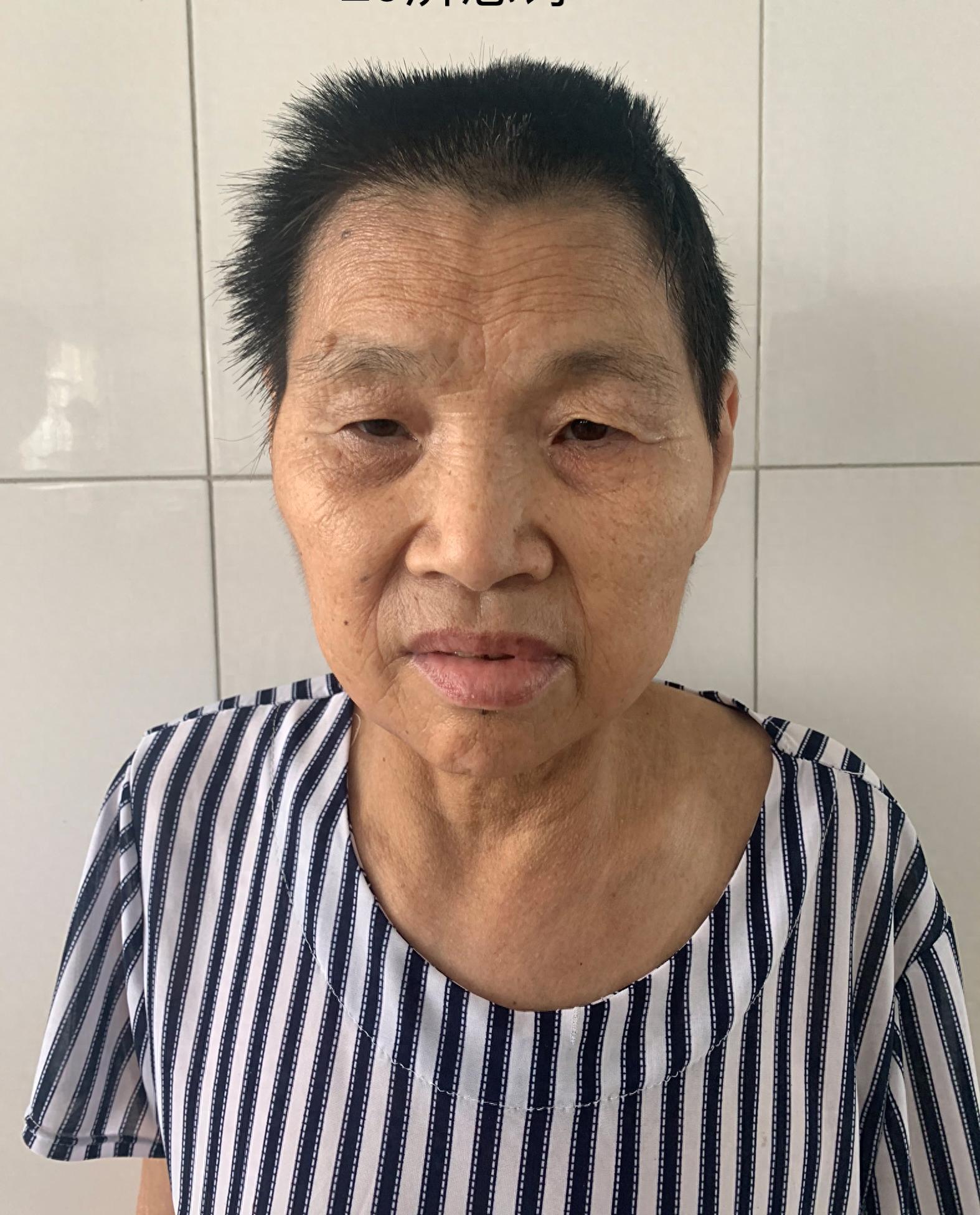 走失者照片 济南市寻亲：五旬女子被救助多年，自...