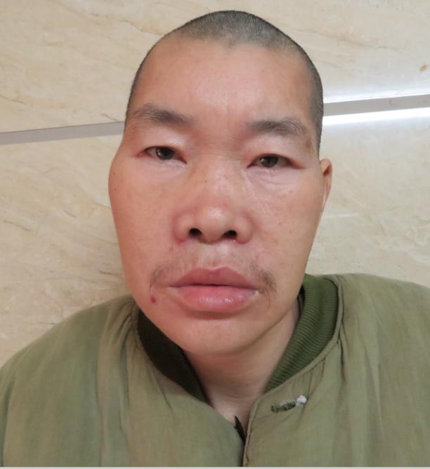 走失者照片 广州市寻亲：中年男子被救助多年，自...