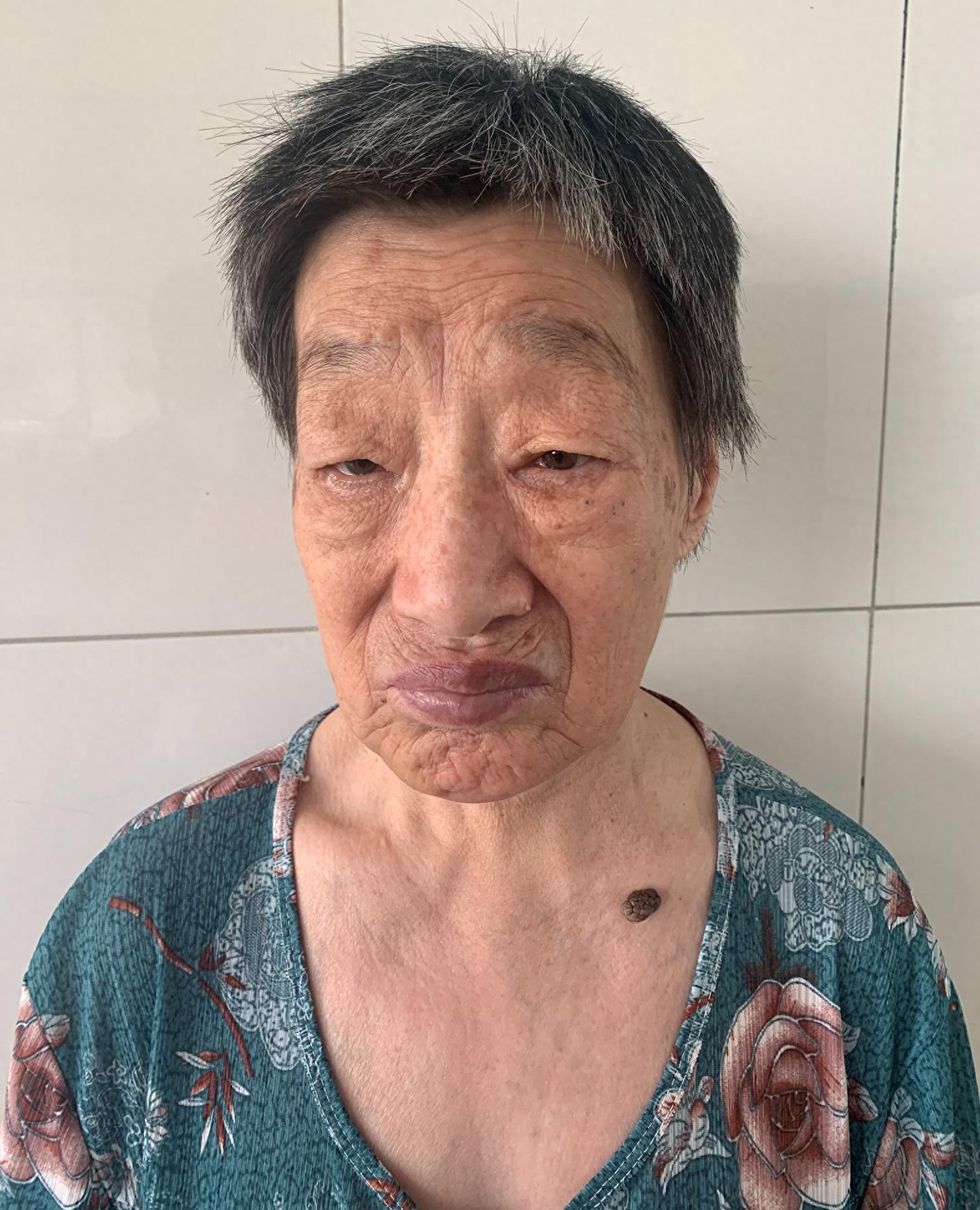 走失者照片 济南市寻亲：六旬老太被救助多年，自...