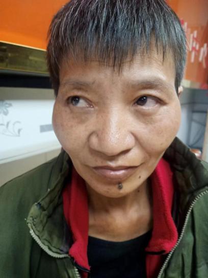 走失者照片 昭通市寻亲：中年女子被救助，穿蓝色...