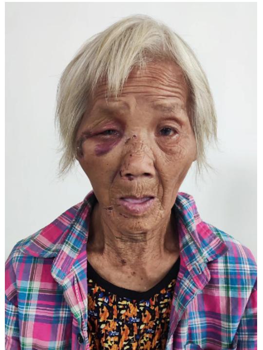 走失者照片 清远市连州市寻亲：七旬老太被救助，...