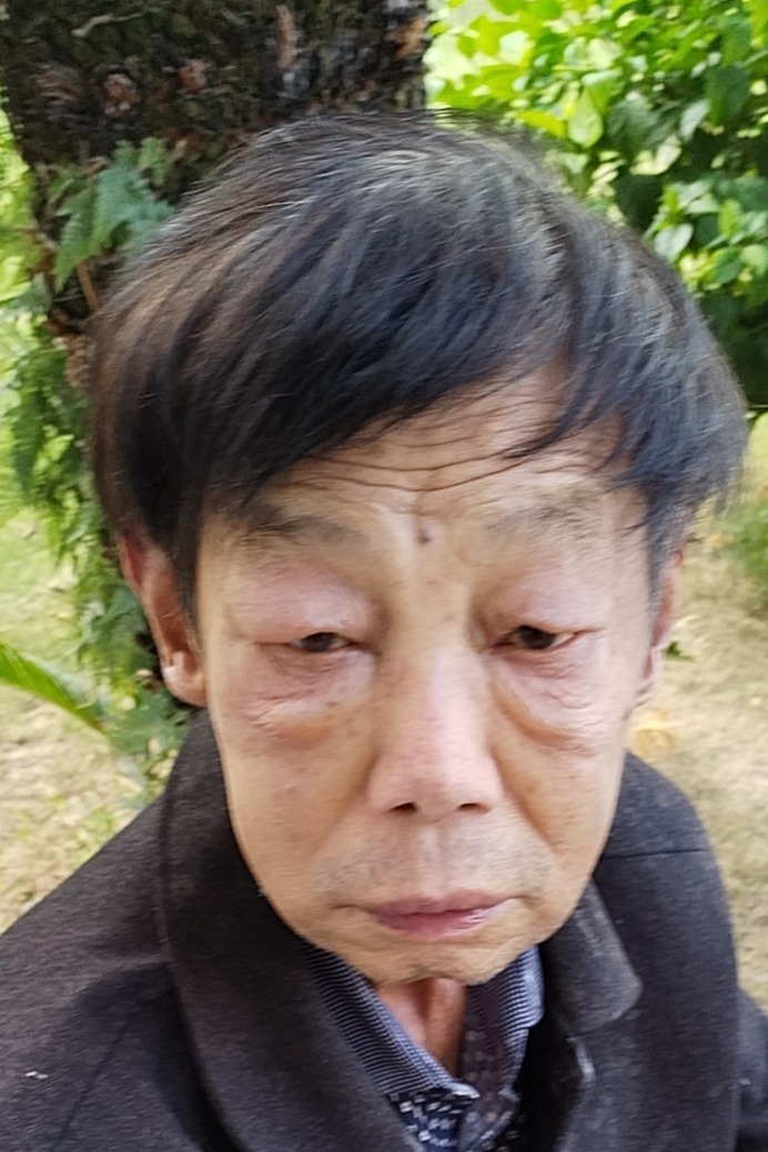 走失者照片 桂林市寻亲：七旬老人被救助，自述叫...