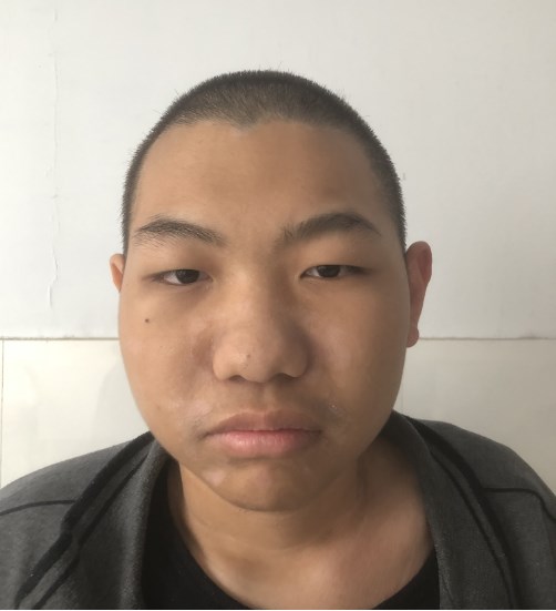 走失者照片 平顶山市寻亲：20岁男生被救助，自...