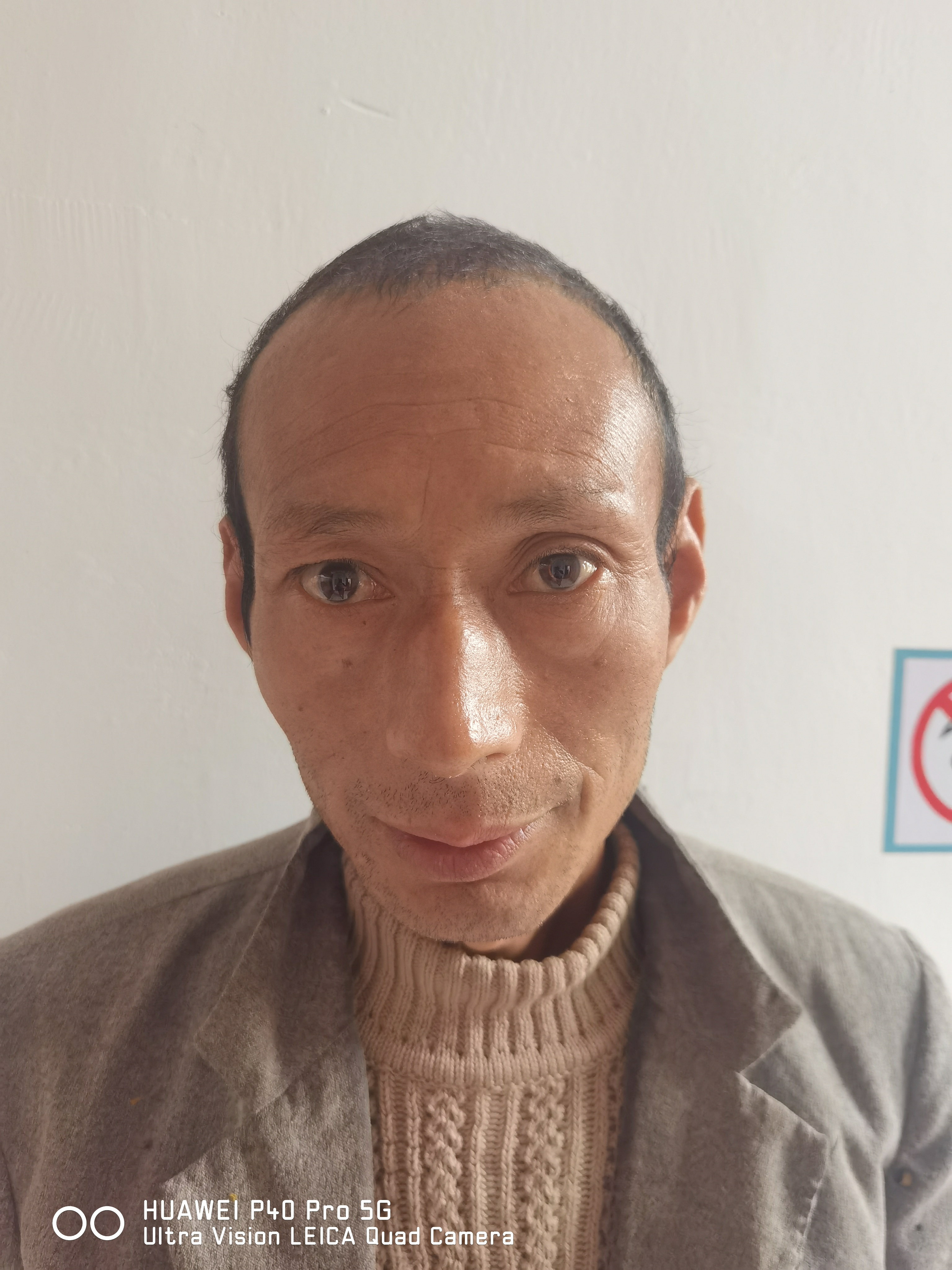 走失者照片 随州市寻亲：六旬老人被救助，穿灰色...
