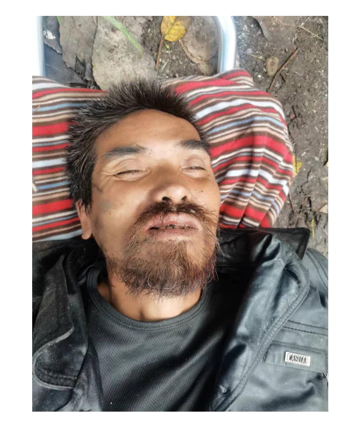 走失者照片 襄阳市老河口市寻亲：六旬老人被救助...