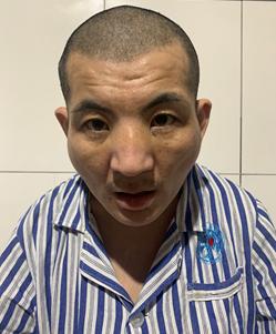 走失者照片 济南市寻亲：青年男子被救助，自述叫...