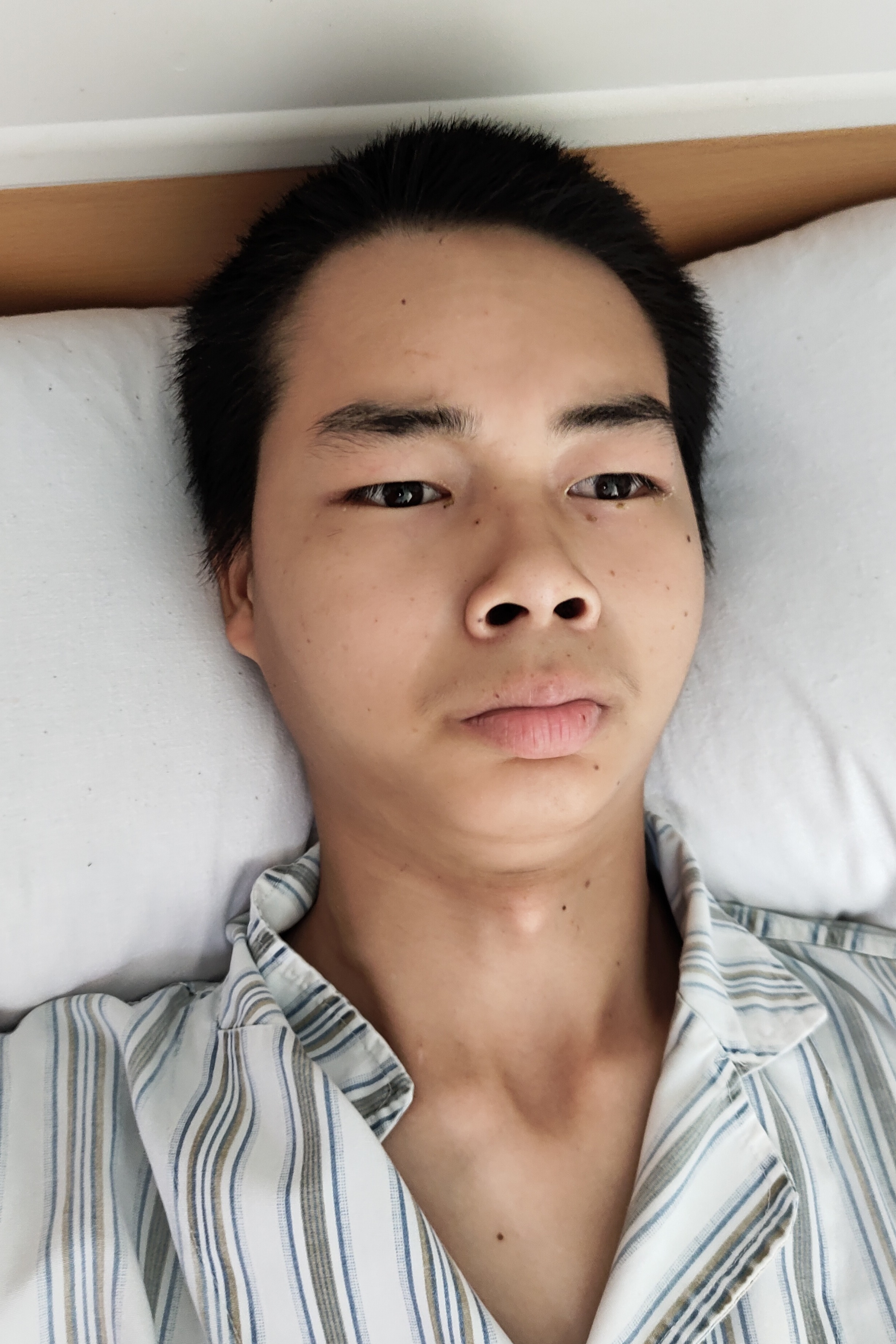 走失者照片 柳州市寻亲：18岁男孩被救助，穿浅...