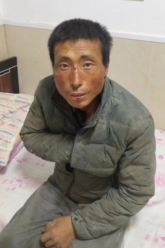 走失者照片 绥化市寻亲：中年男子被救助，自述叫...