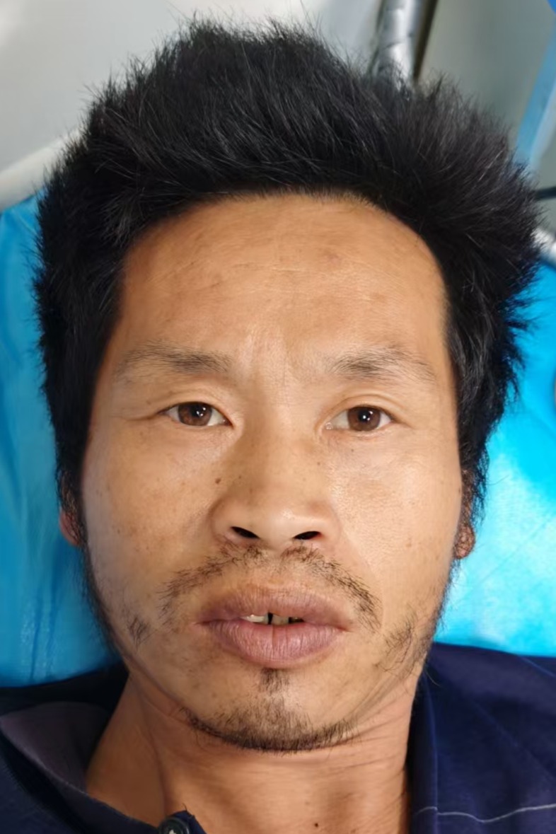 走失者照片 全国救助站