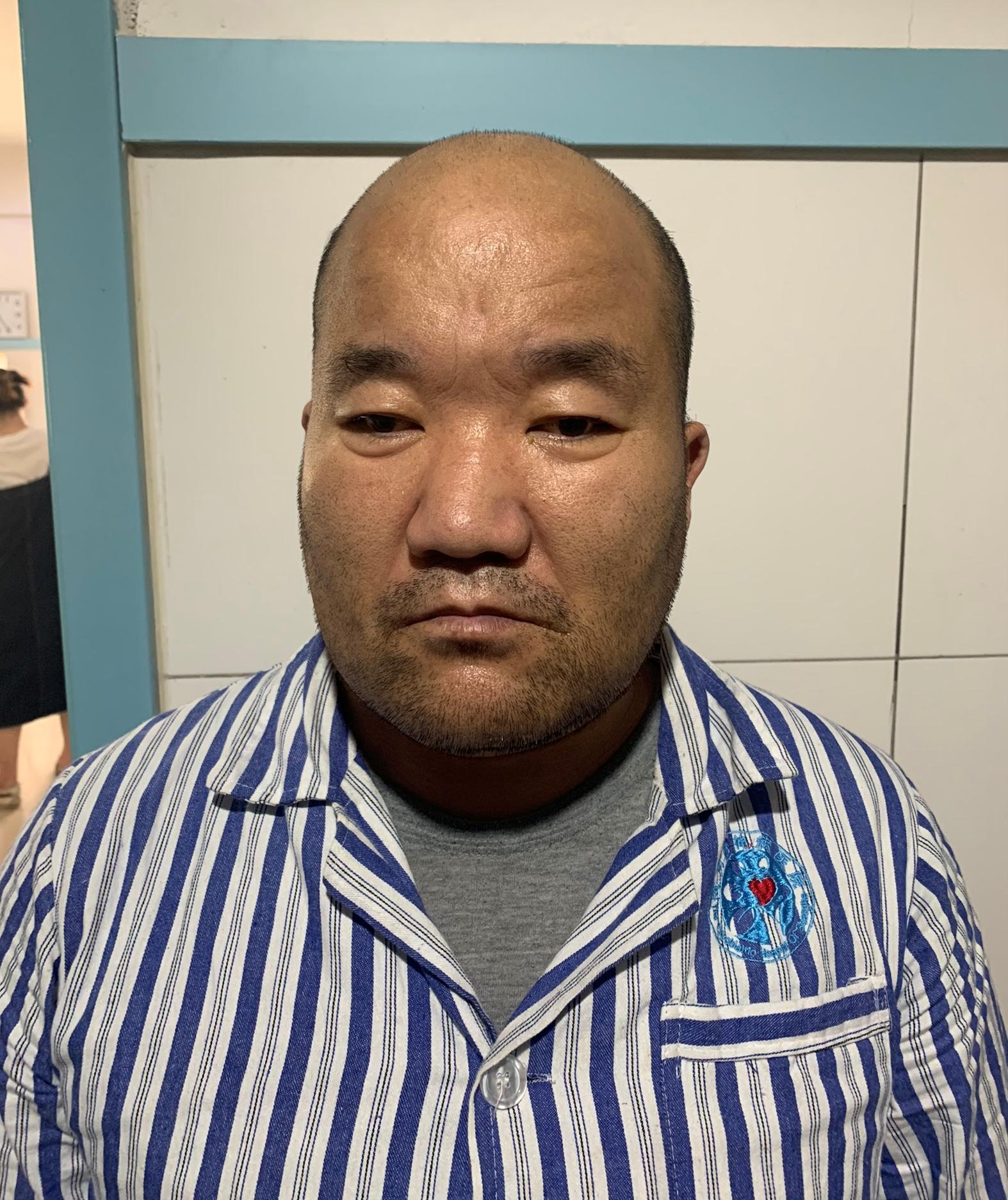 走失者照片 济南市寻亲：中年男子被救助多年，高...