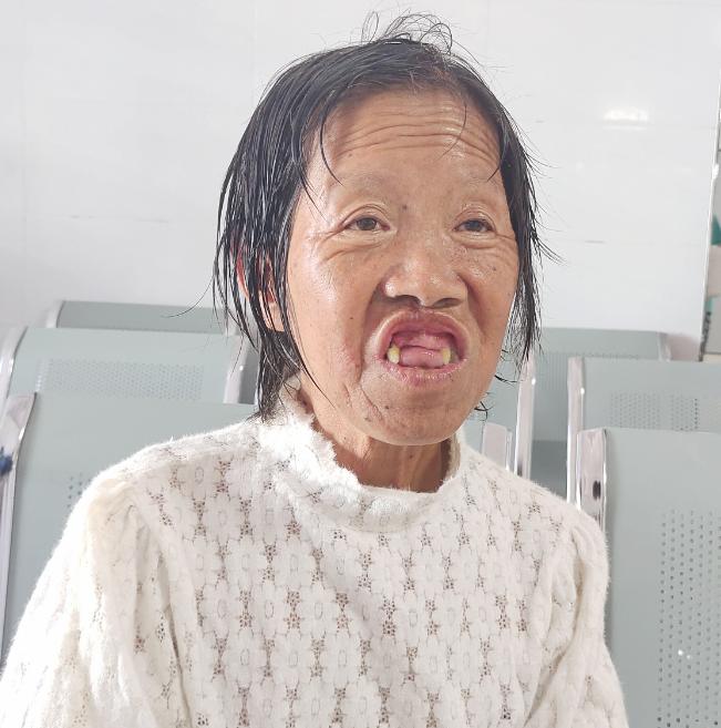 走失者照片 石家庄市寻亲：六旬老太被救助，门牙...