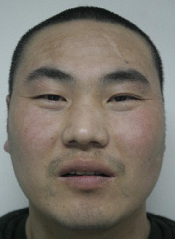 走失者照片 济南市寻亲：五旬男子被救助多年，高...