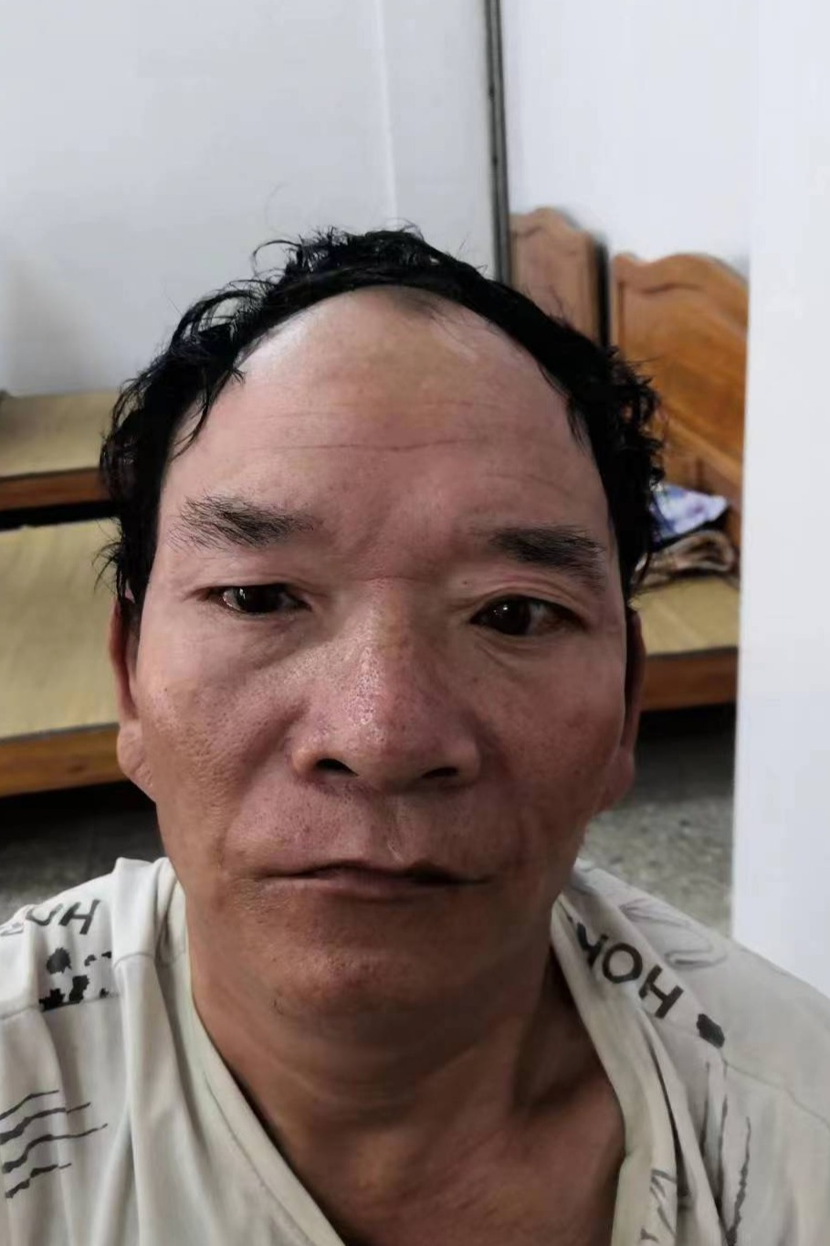 走失者照片 玉林市寻亲：五旬男子被救助，穿黑白...