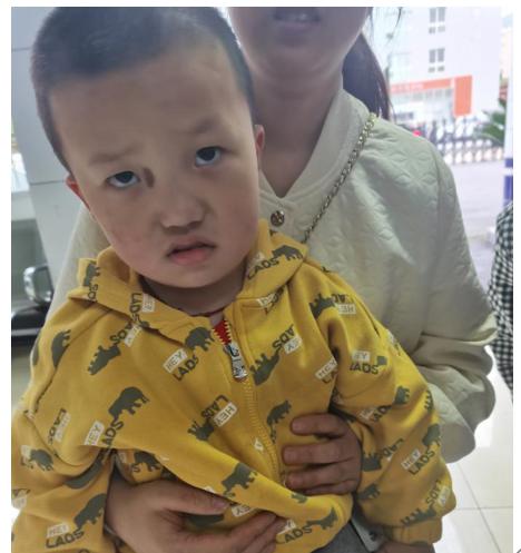 走失者照片 重庆市寻亲：3岁男童自幼被救助，右...
