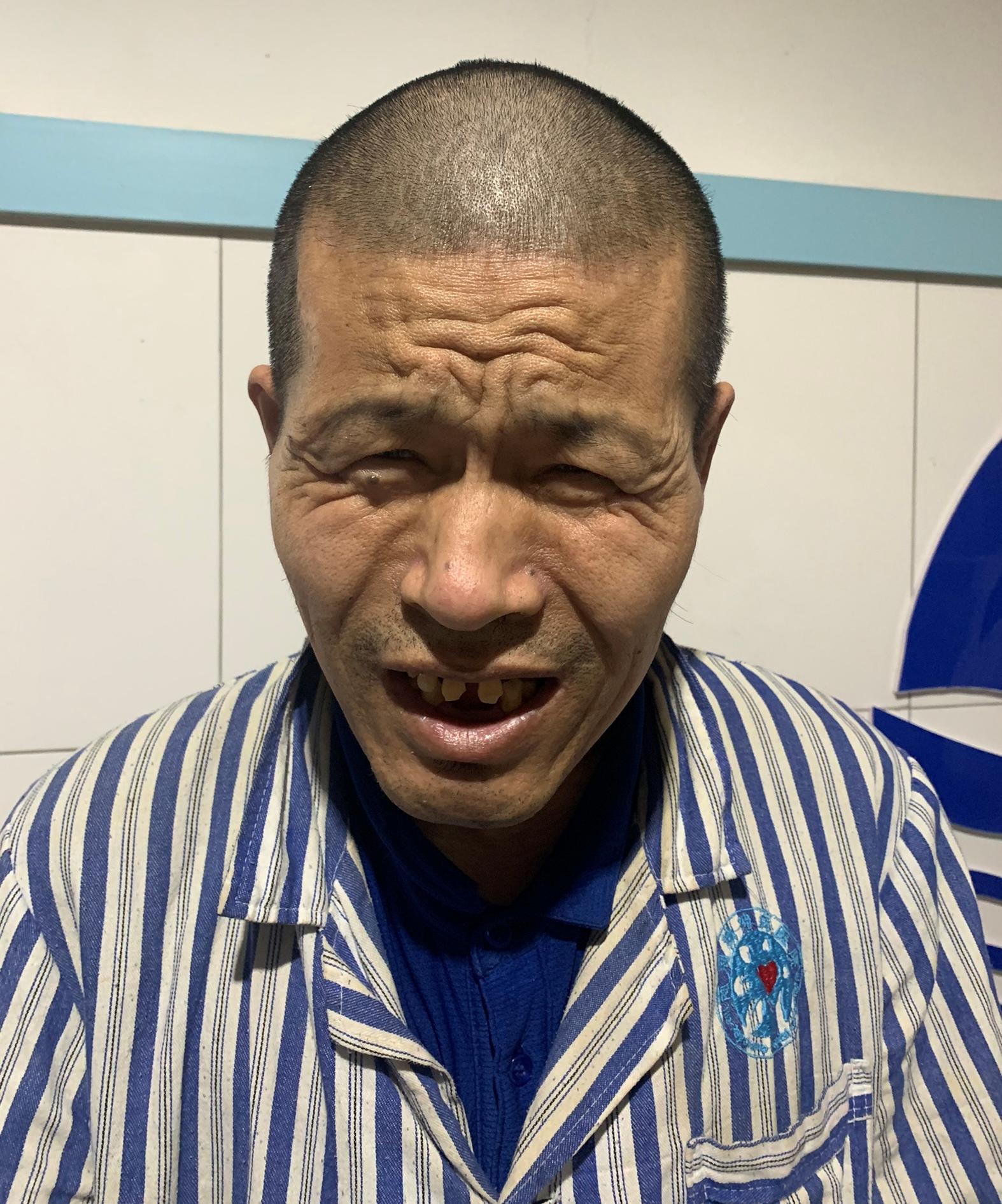 走失者照片 寻亲：中年男子在济南市被救助多年，...