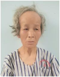 走失者照片 阳江市寻亲：七旬老太被救助，白色短...