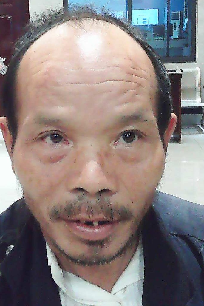 走失者照片 全国救助站
