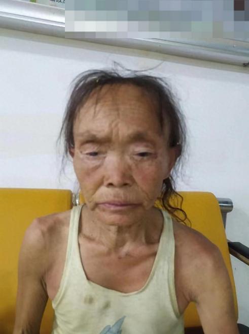 走失者照片 荆门市京山市寻亲：五旬女子被救助，...