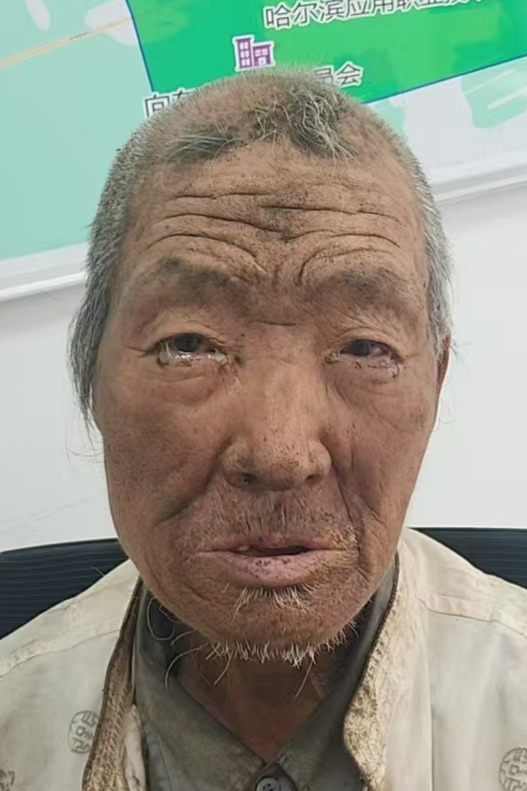 走失者照片 全国救助站