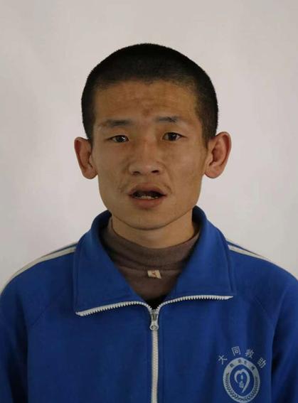 走失者照片 大同市寻亲：青年男子被救助，高1米...