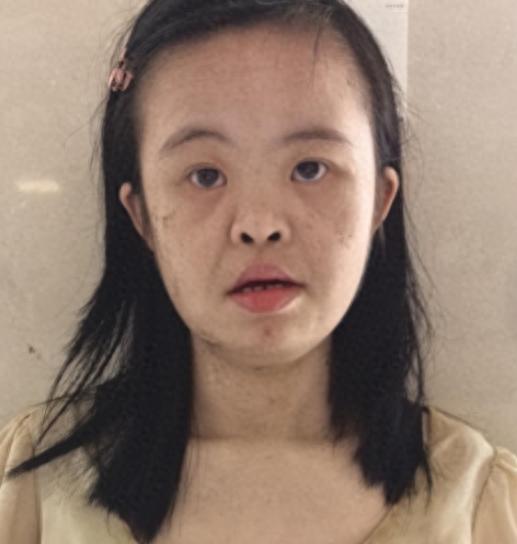 走失者照片 揭阳市寻亲：青年女子被救助，高约1...