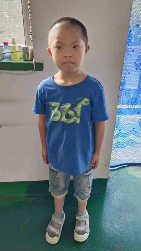 走失者照片 衡水市寻亲：深州市10岁女孩自幼被...