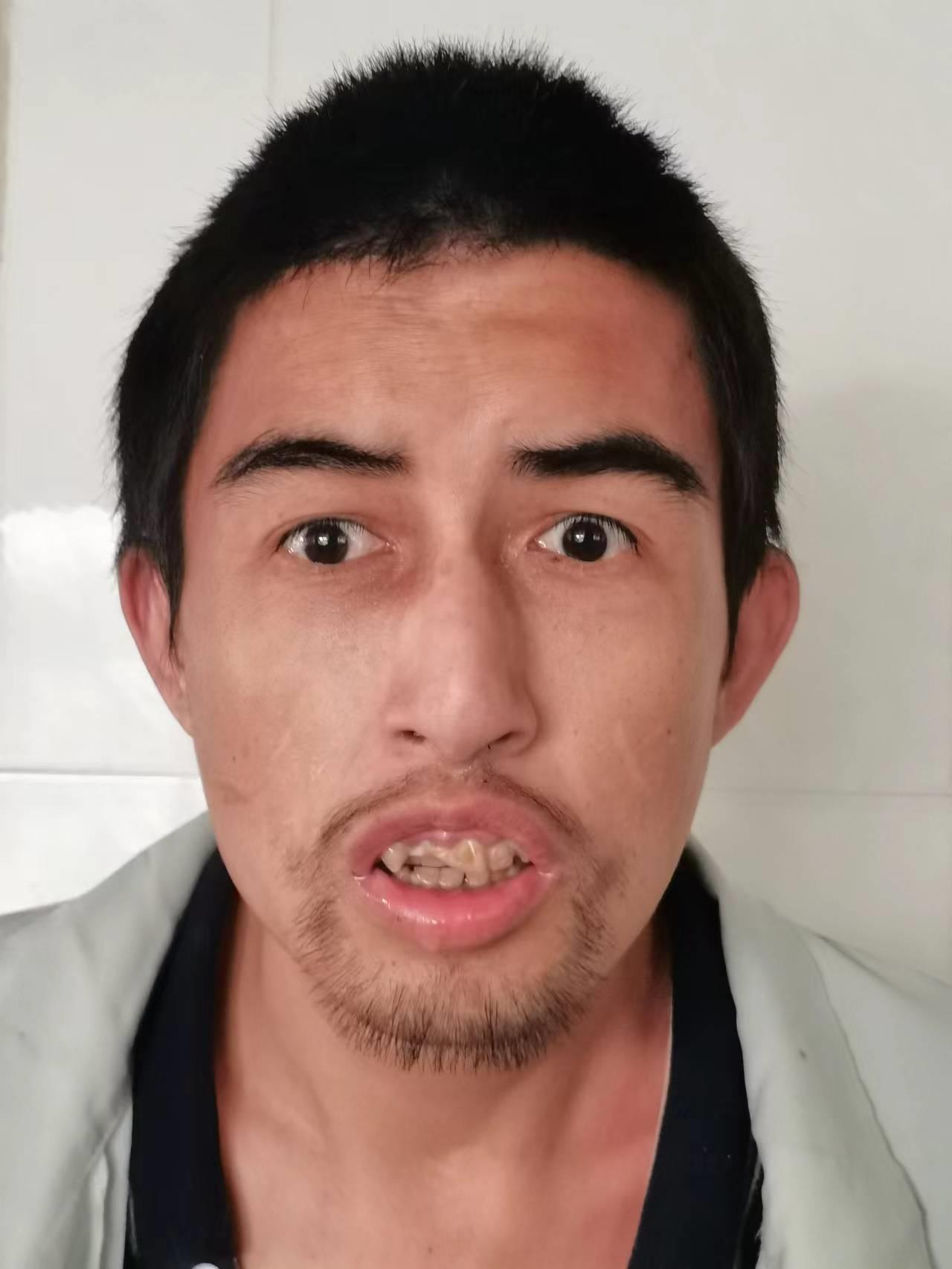 走失者照片 枣庄市滕州市寻亲：青年男子被救助多...