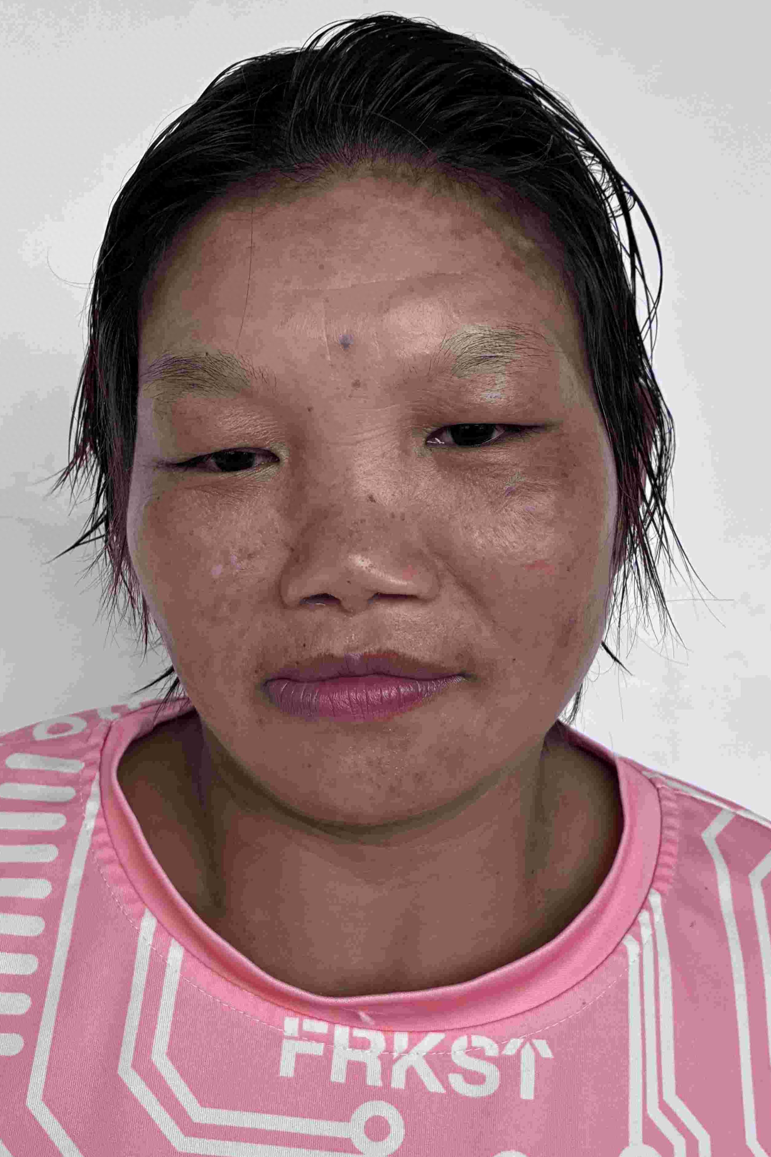 走失者照片 南阳市寻亲：青年女子被救助，自述叫...